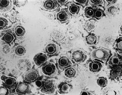Foto "virus" herpes simplex